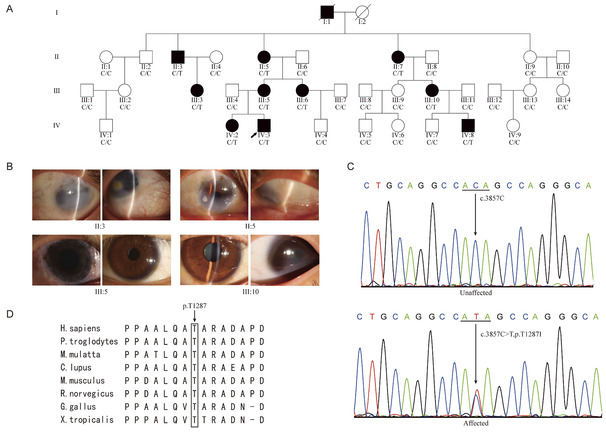GBF1 deficiency causes cataracts in human and mouse