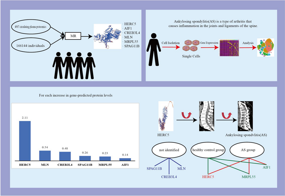 Identification of novel protein biomarkers and therapeutic targets for ankylosing spondylitis using human circulating plasma proteomics and genome analysis