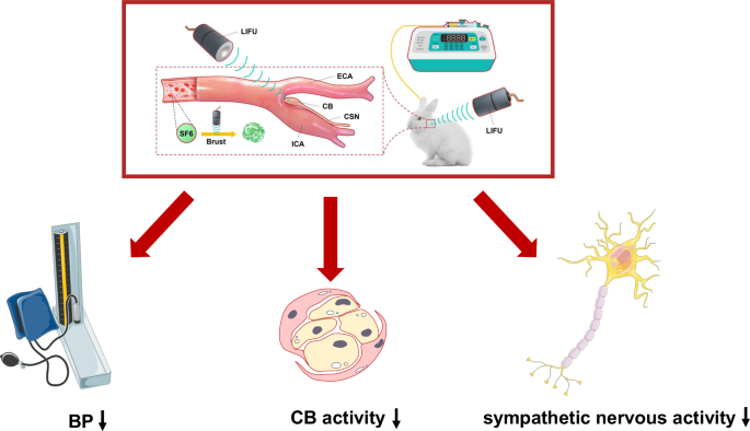 Low-intensity focused ultrasound combined with microbubbles for non-invasive downregulation of rabbit carotid body activity in the treatment of hypertension