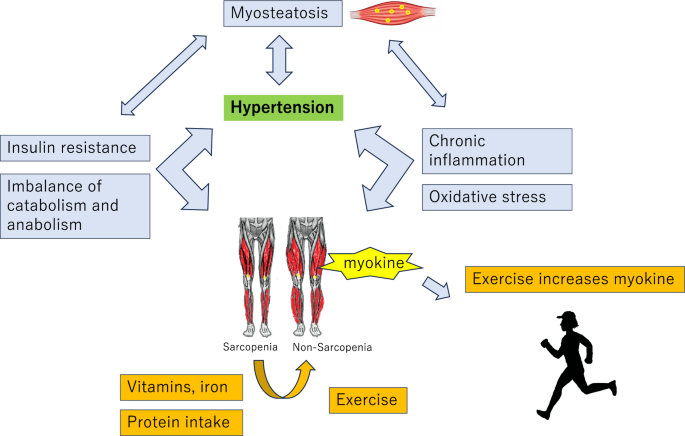 Sarcopenia as a risk factor for hypertension