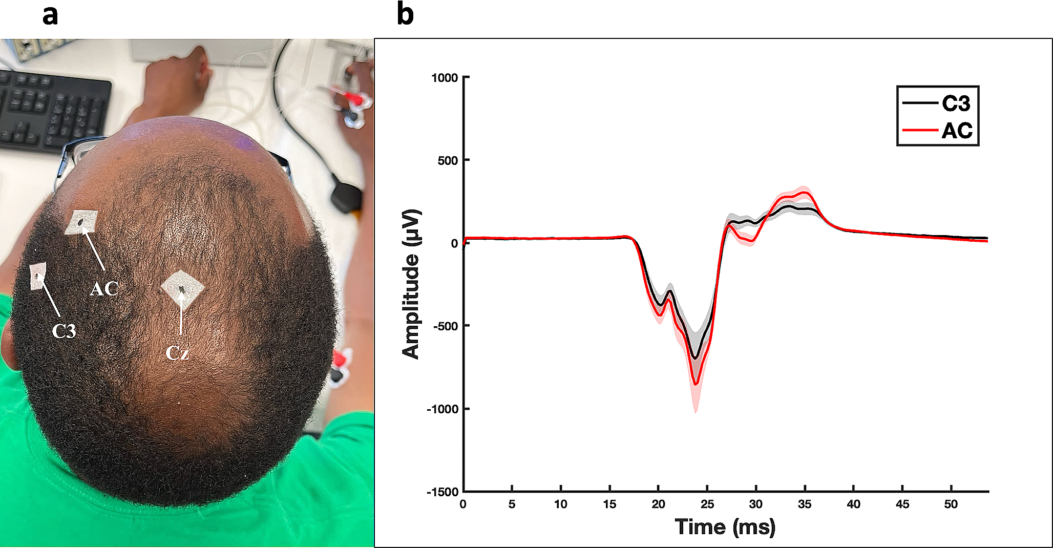 Scalp acupuncture guidance for identifying the optimal site for transcranial electrical stimulation of the hand