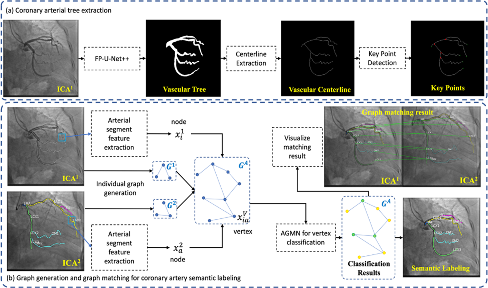 A Review on Machine Learning for Arterial Extraction and Quantitative Assessment on Invasive Coronary Angiograms