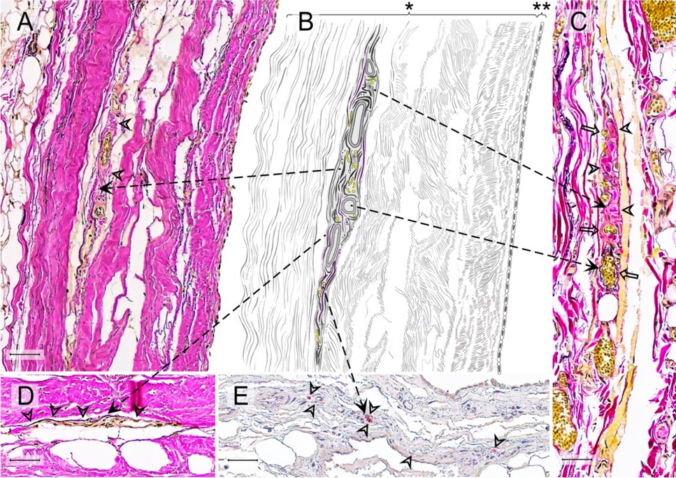 Proprioceptors of the human pericardium