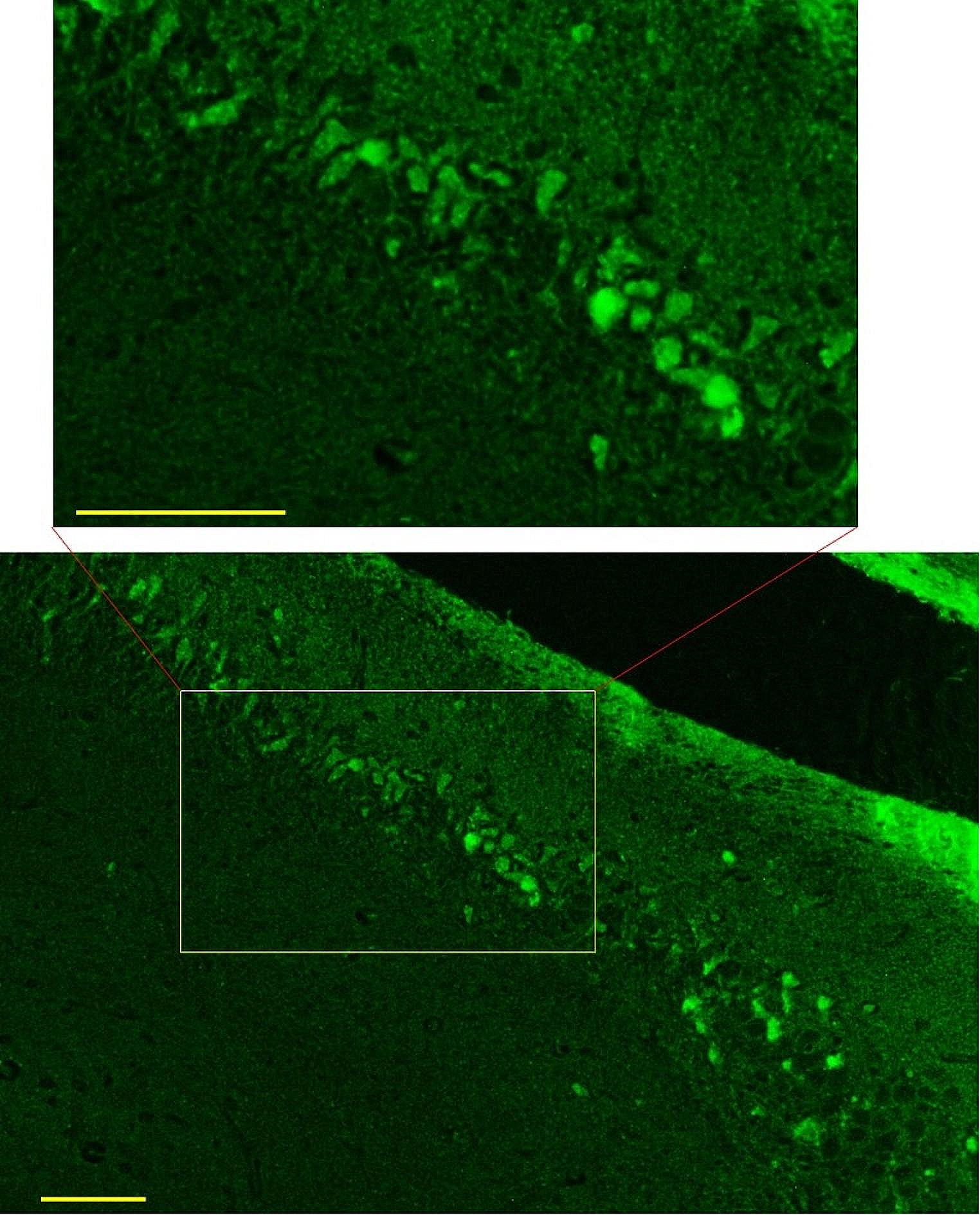 Induced expression of rabies glycoprotein in the dorsal hippocampus enhances hippocampal dependent memory in a rat model of Alzheimer’s disease