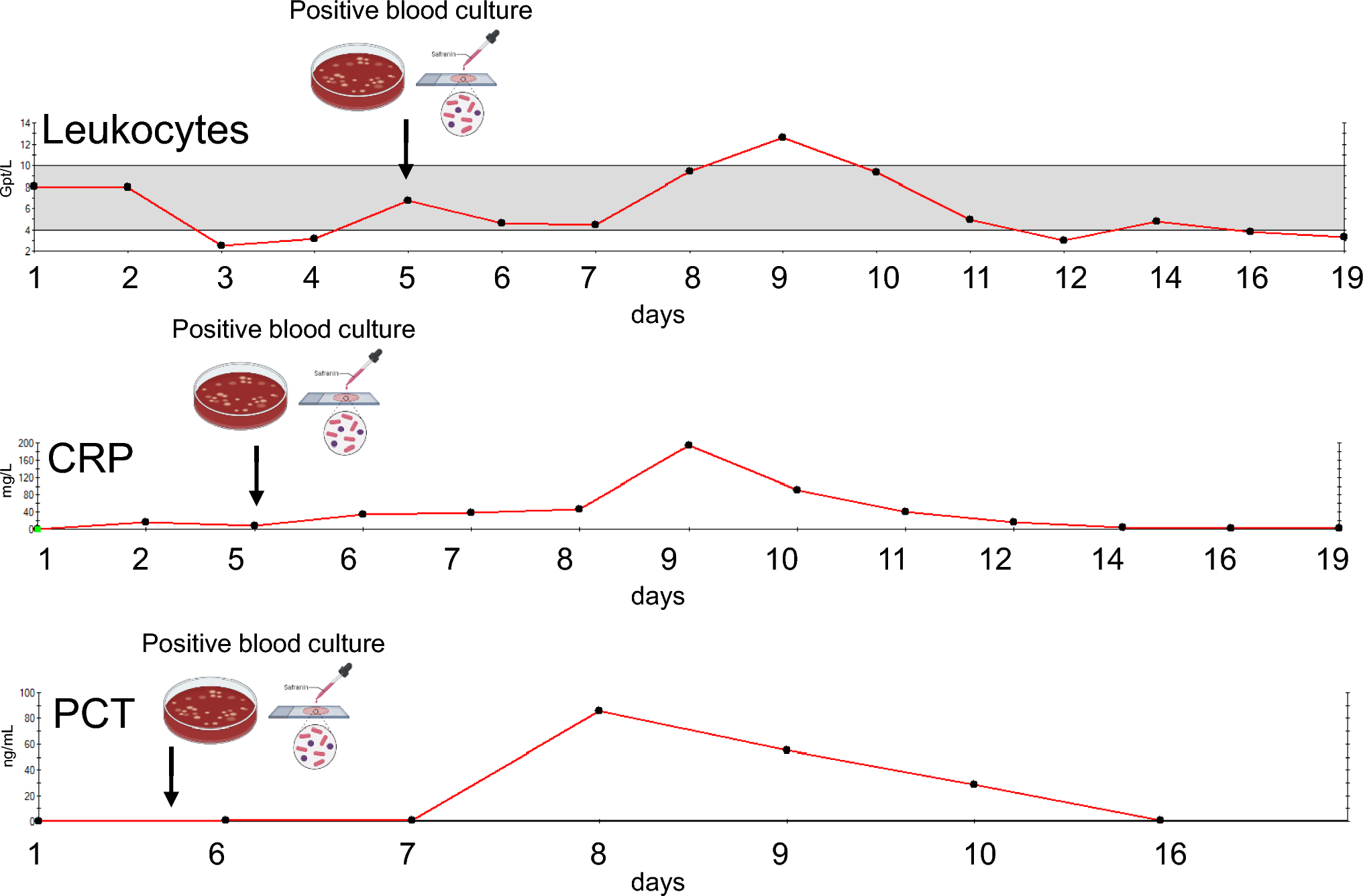 Lautropia mirabilis sepsis in immunodeficiency: first report and genomic features