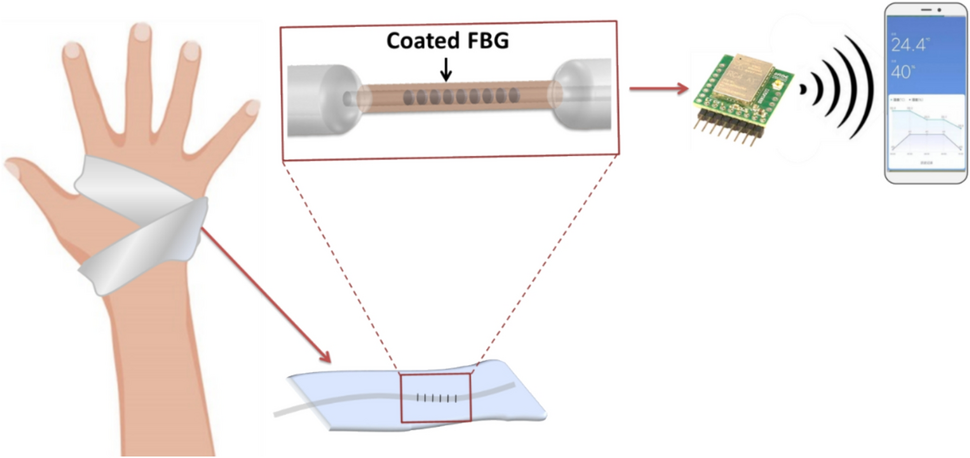 Smart bandages with integrated sensors for real-time monitoring of wound inflammation and infection