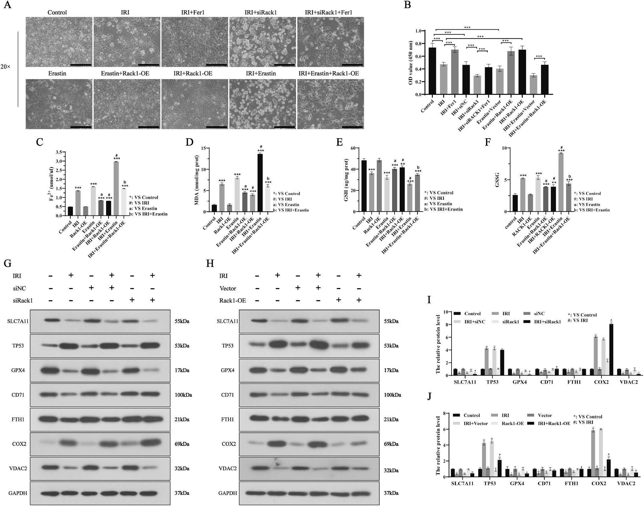 The protective role of RACK1 in hepatic ischemia‒reperfusion injury-induced ferroptosis