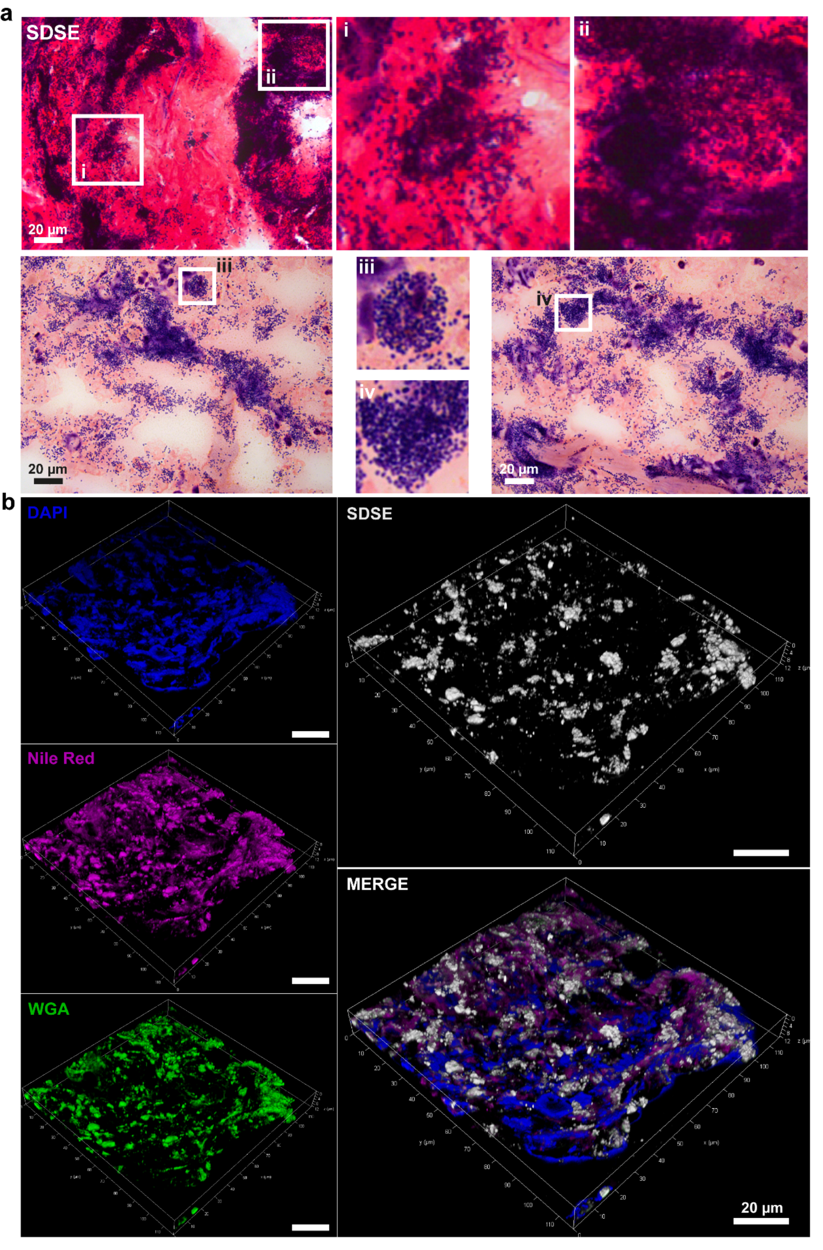 Streptokinase reduces Streptococcus dysgalactiae subsp. equisimilis biofilm formation