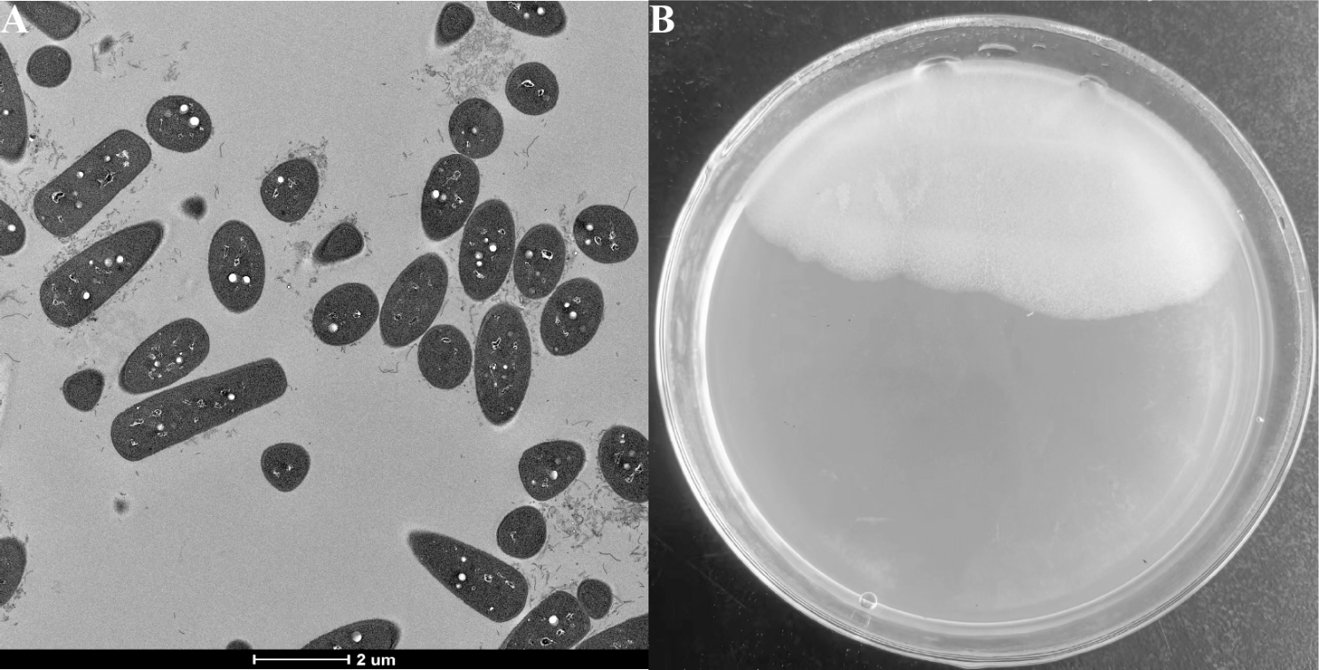 Novel genomic and phenotypic traits of polyhydroxyalkanoate-producing bacterium ZZQ-149, the type strain of Halomonas qinghailakensis