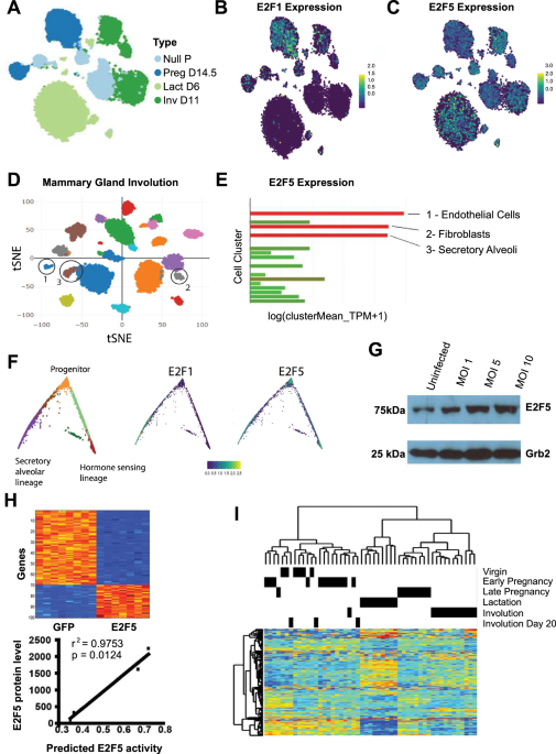 Insight into mammary gland development and tumor progression in an E2F5 conditional knockout mouse model