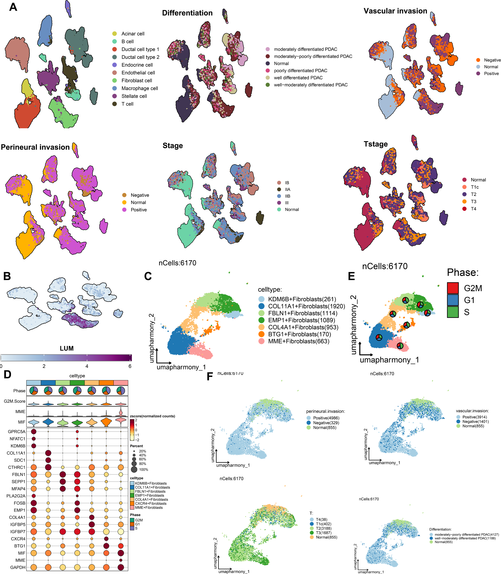 Metabolic and Immunological Implications of MME+CAF-Mediated Hypoxia Signaling in Pancreatic Cancer Progression: Therapeutic Insights and Translational Opportunities