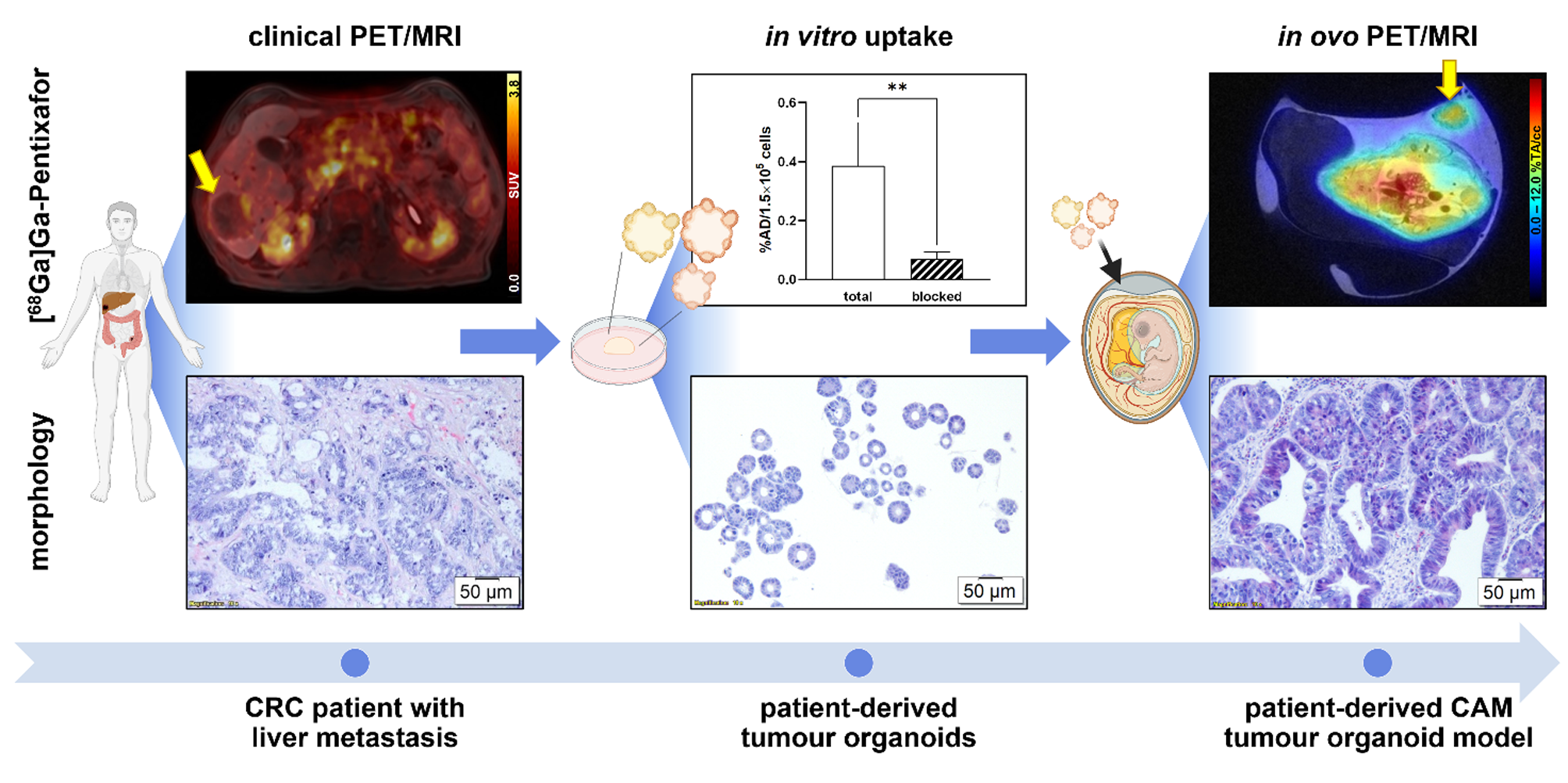 An in vivo tumour organoid model based on the chick embryonic chorioallantoic membrane mimics key characteristics of the patient tissue: a proof-of-concept study