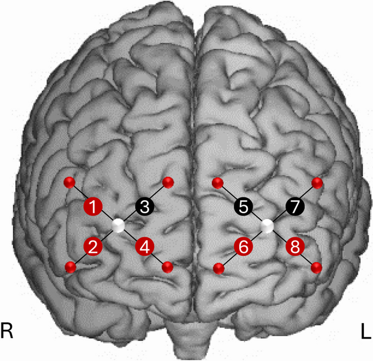 Investigating Cerebello-Frontal Circuits Associated with Emotional Prosody: A Double-Blind tDCS and fNIRS study