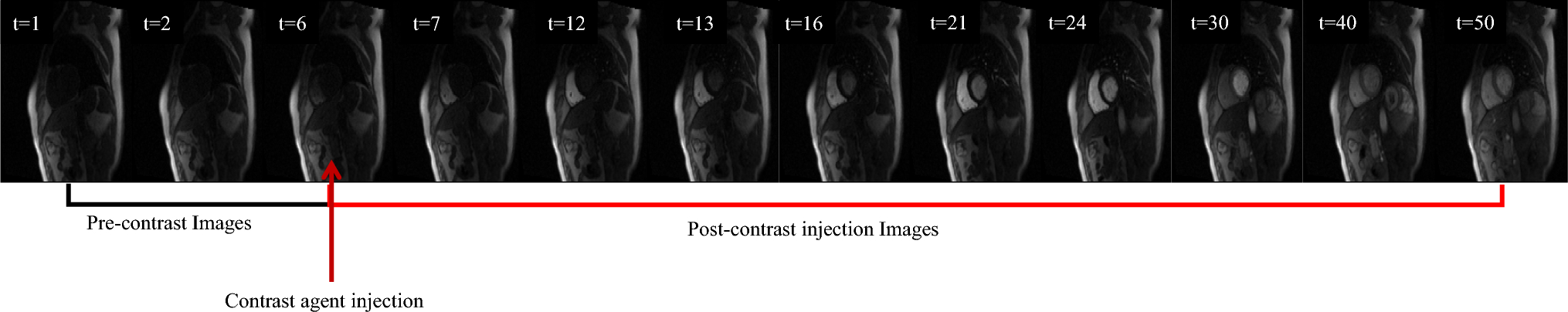 Deep learning-based segmentation of left ventricular myocardium on dynamic contrast-enhanced MRI: a comprehensive evaluation across temporal frames