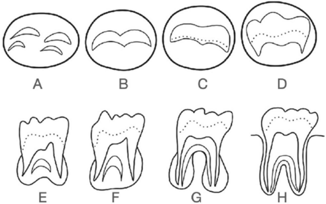 The Cayor Atlas: a black Senegalese dental atlas for permanent tooth formation