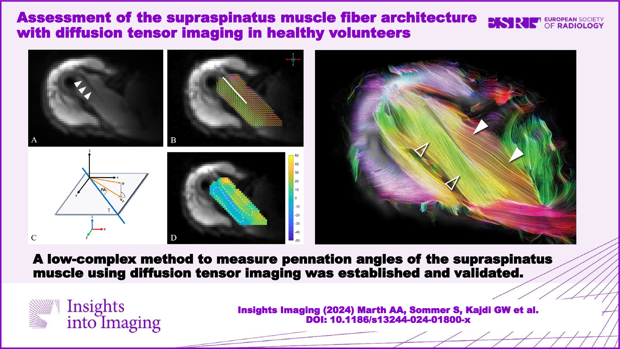 Assessment of the supraspinatus muscle fiber architecture with diffusion tensor imaging in healthy volunteers