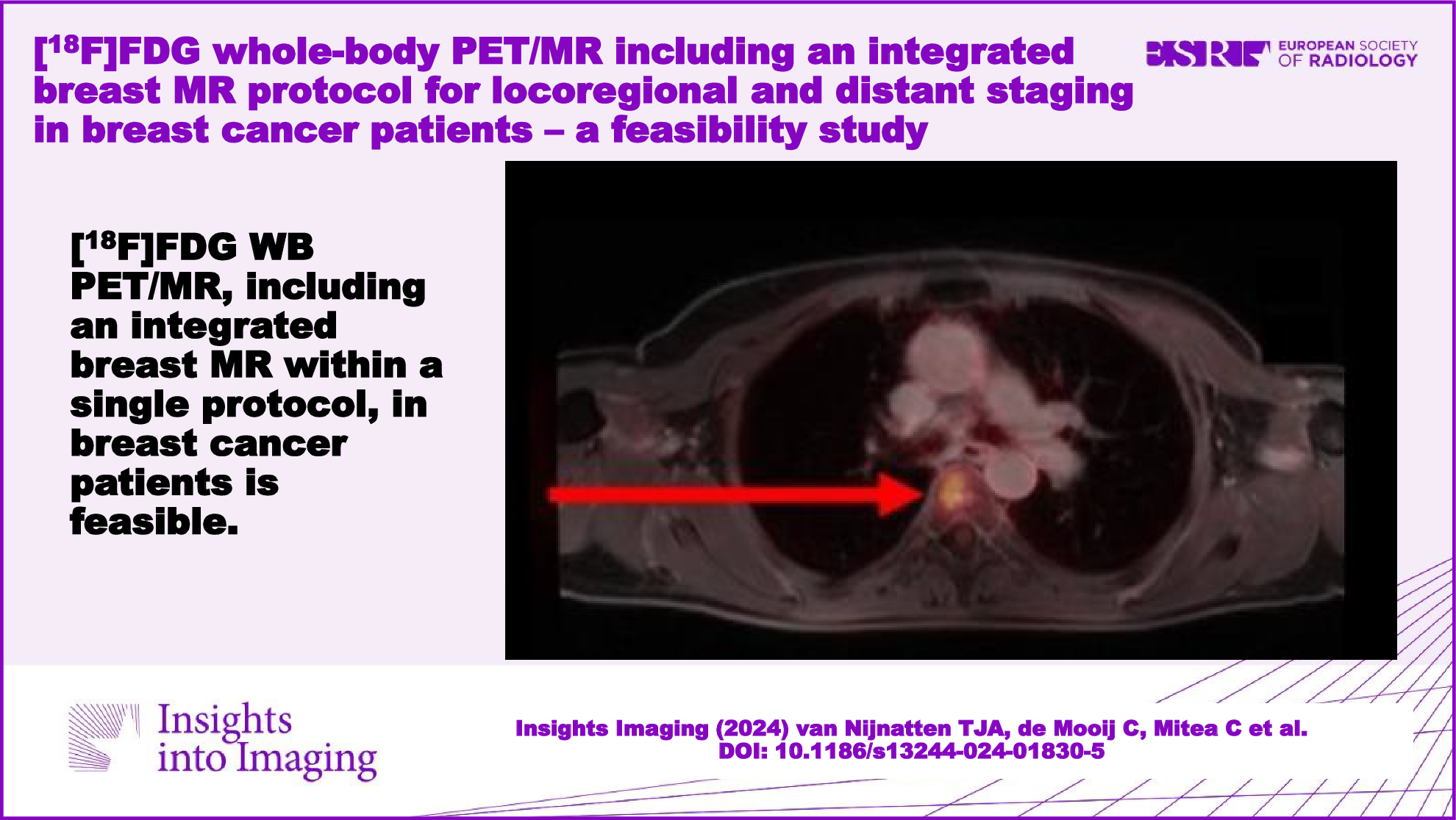 [18F]FDG whole-body PET-MR including an integrated breast MR protocol for locoregional and distant staging in breast cancer patients—a feasibility study