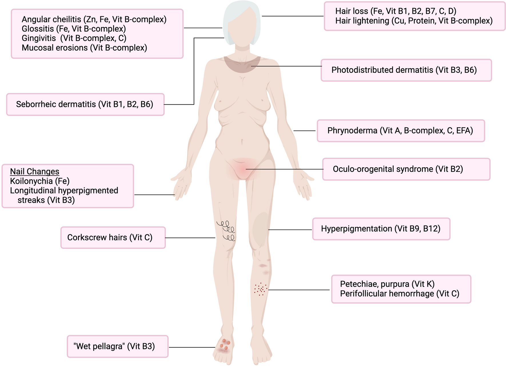 Cutaneous Signs of Nutritional Deficiencies
