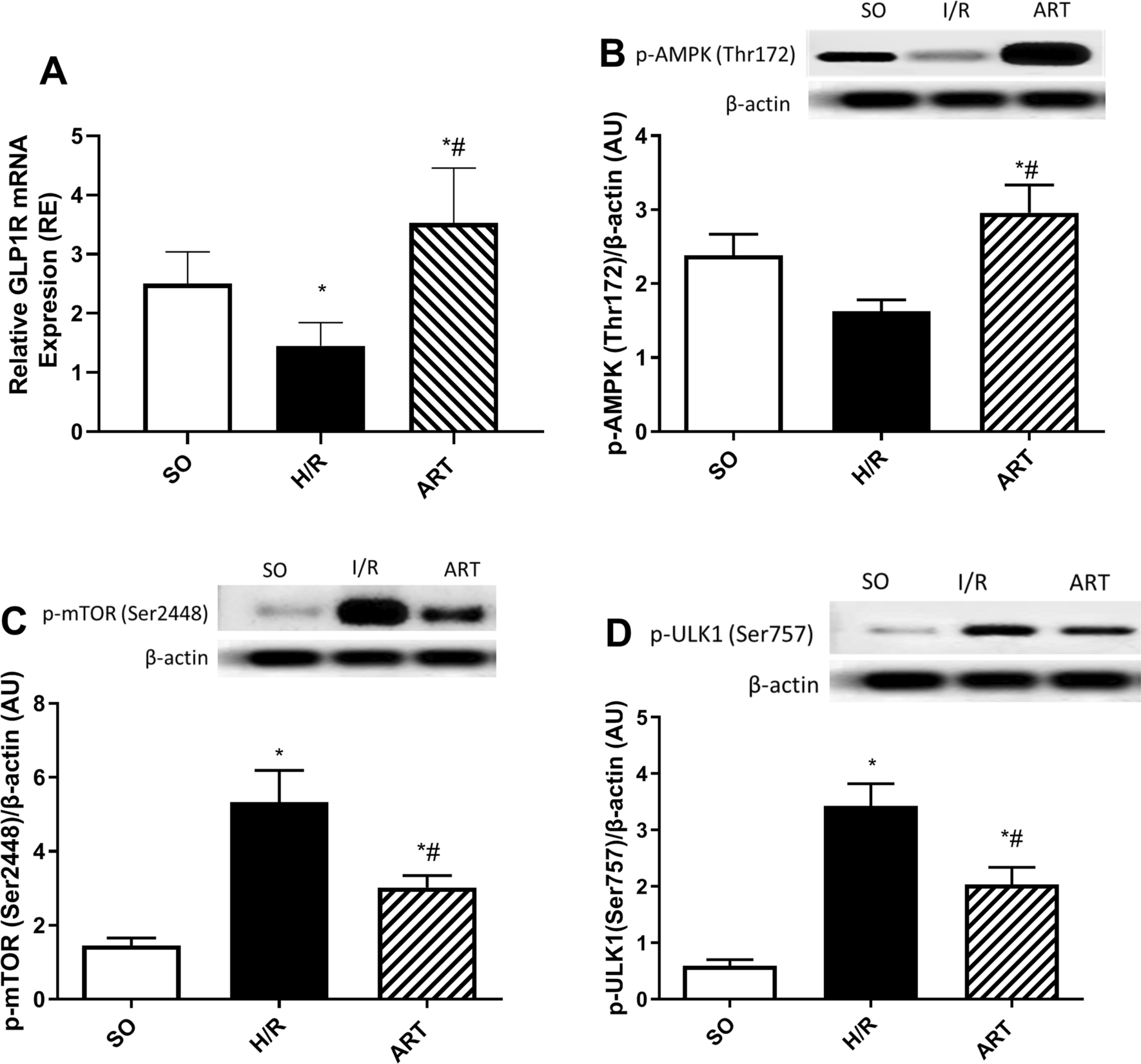 Artesunate-driven autophagy: a shield against liver hypoxia/reoxygenation insult in rats via modulation of GLP1R, the chief metabolic kinase AMPK, mTOR, ULK1, P70S6K, cyclin D1, Akt, and GSK3β