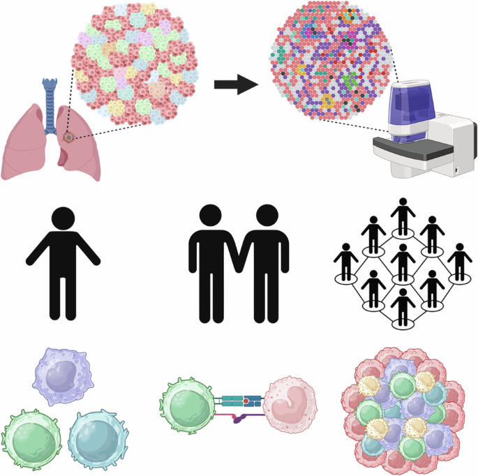 Spatial multiplexed immunofluorescence analysis reveals coordinated cellular networks associated with overall survival in metastatic osteosarcoma