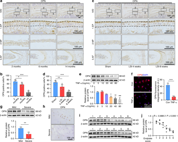 Osteopontin deficiency promotes cartilaginous endplate degeneration by enhancing the NF-κB signaling to recruit macrophages and activate the NLRP3 inflammasome