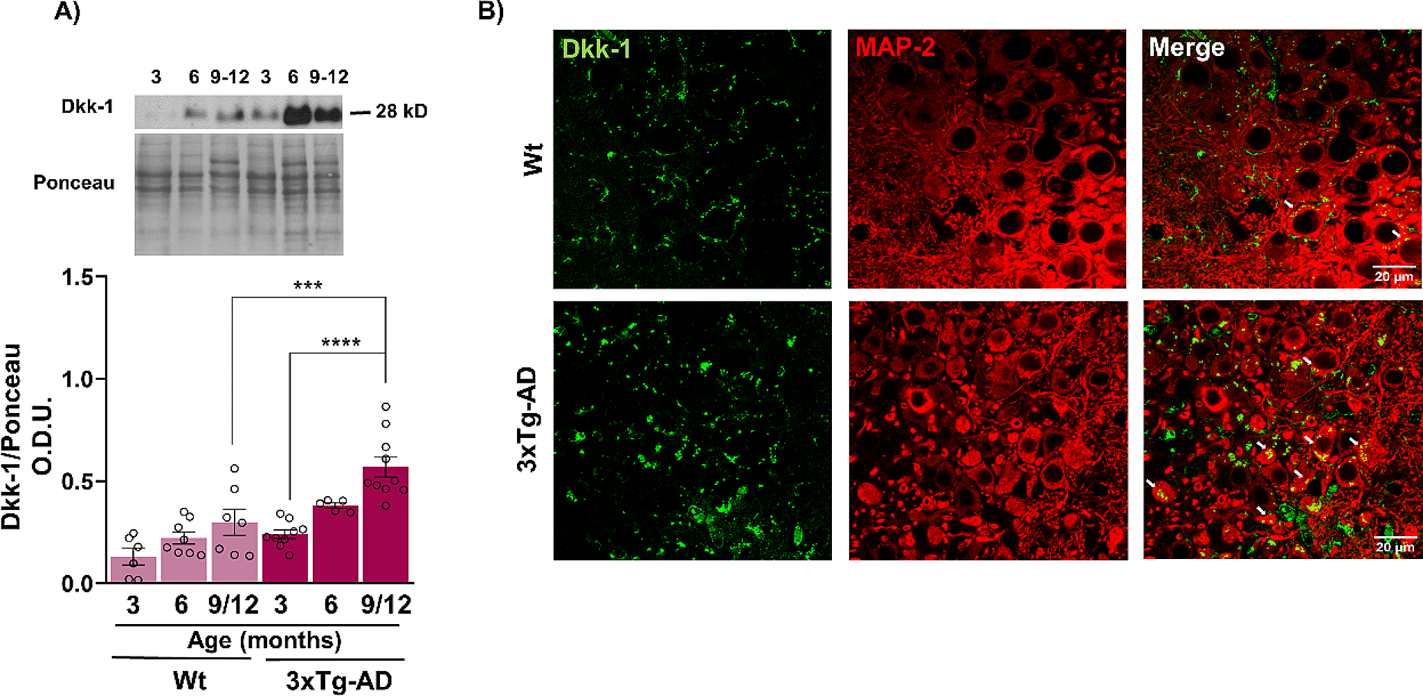 Age- and Sex-Associated Wnt Signaling Dysregulation is Exacerbated from the Early Stages of Neuropathology in an Alzheimer’s Disease Model