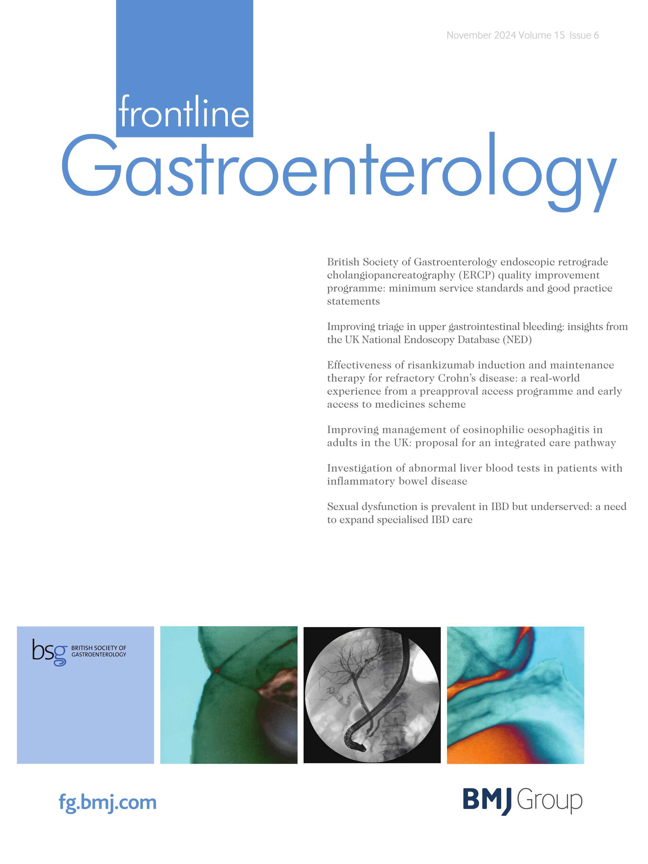 Improving triage in upper gastrointestinal bleeding: insights from the UK National Endoscopy Database (NED)