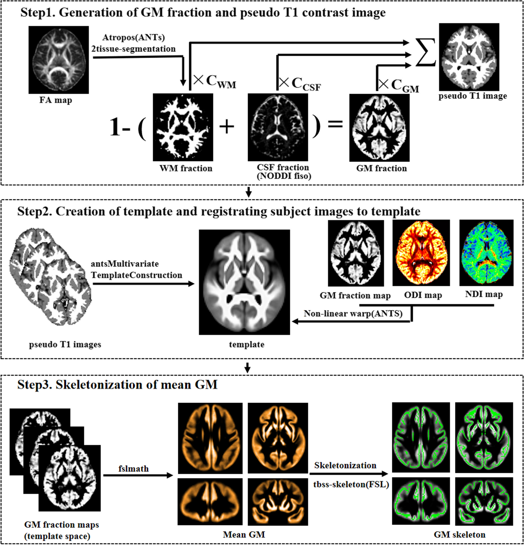 Cortical microstructural alterations in different stages of Parkinson’s disease