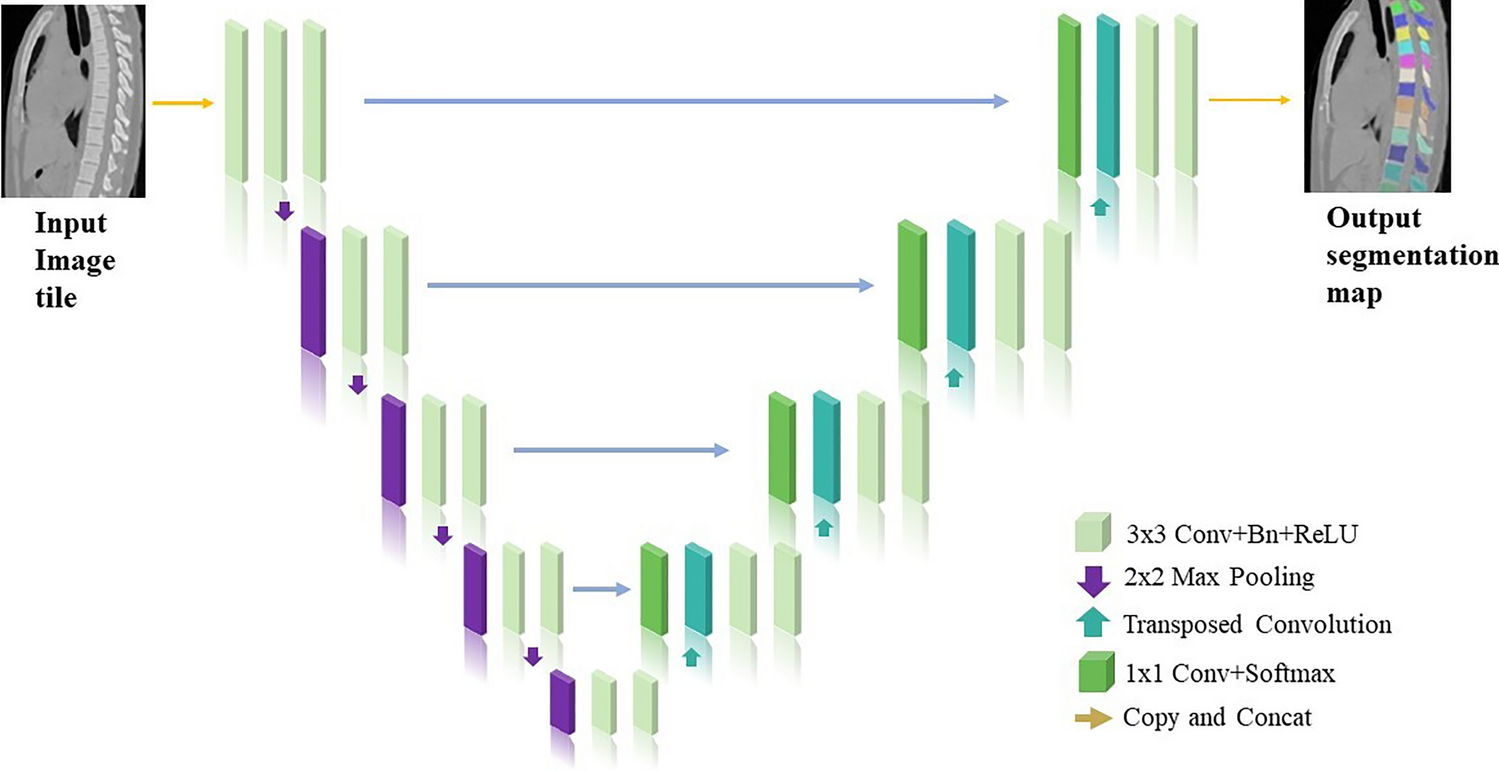 3D U-Net Neural Network Architecture-Assisted LDCT to Acquire Vertebral Morphology Parameters: A Vertebral Morphology Comprehensive Analysis in a Chinese Population