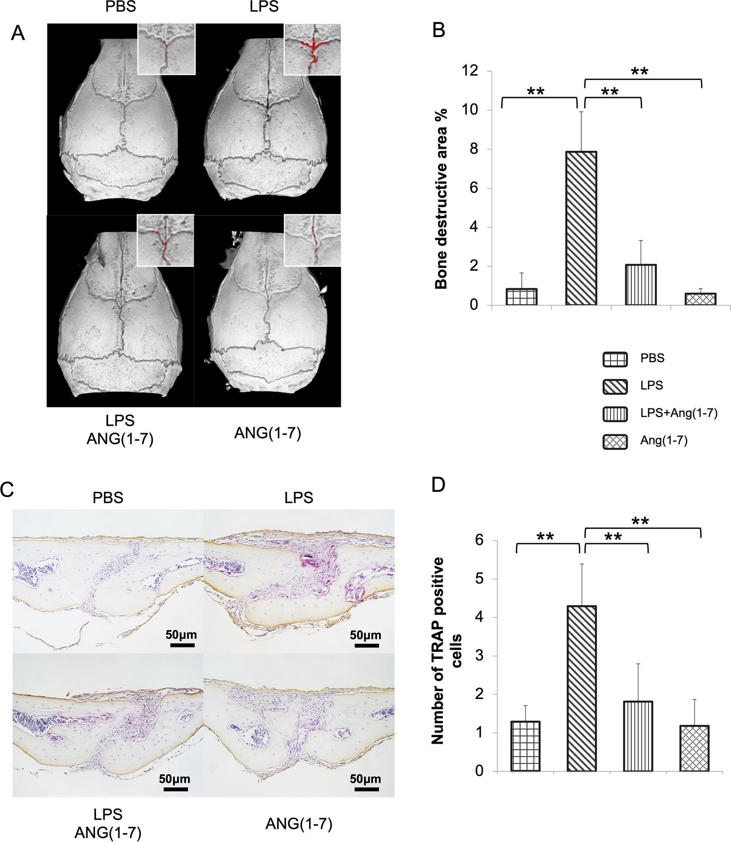 Exogenous Angiotensin-(1–7) Provides Protection Against Inflammatory Bone Resorption and Osteoclastogenesis by Inhibition of TNF-α Expression in Macrophages