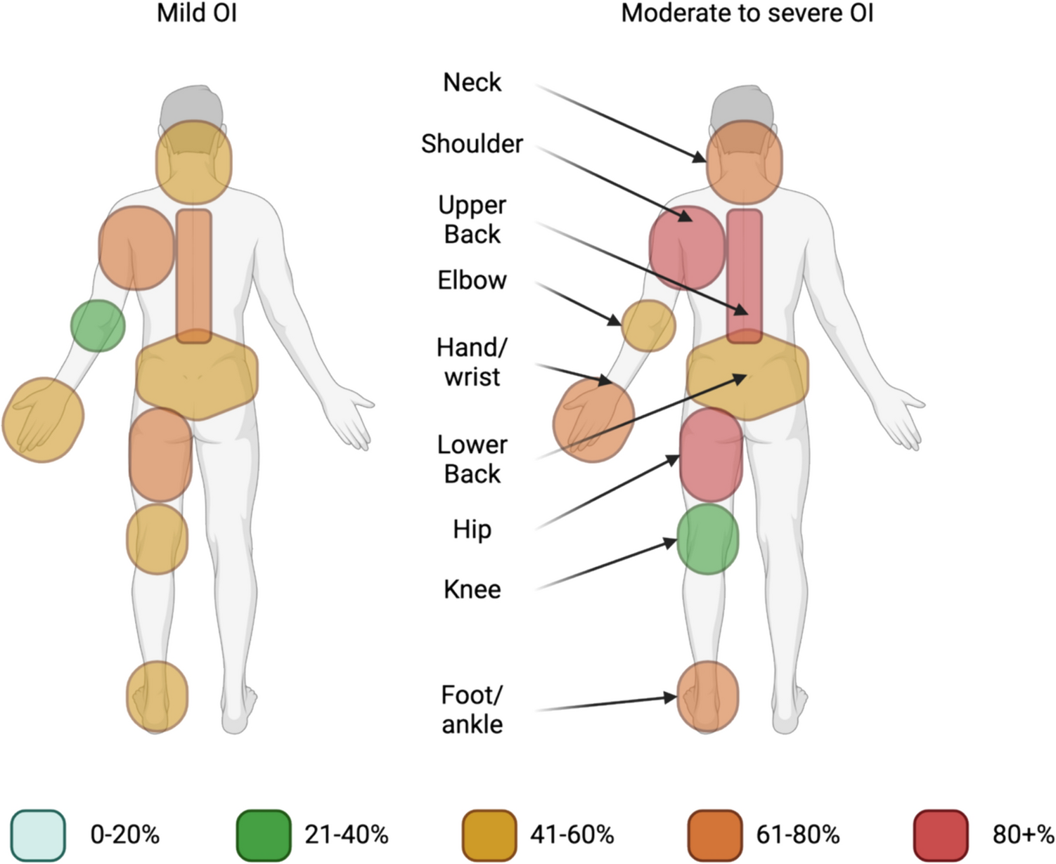 Evaluation of the Nordic Musculoskeletal Questionnaire for Measuring Prevalence and the Consequence of Pain in a Danish Adult OI Population: A Pilot Study