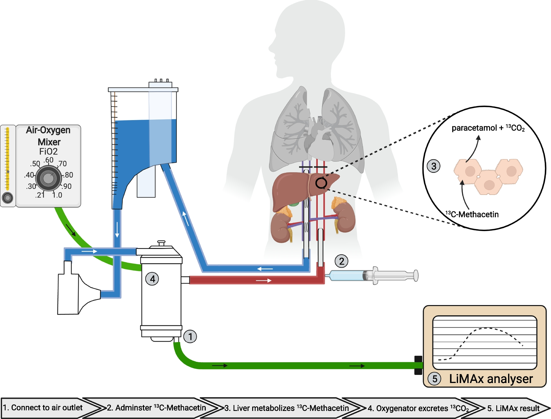 Liver function maximum capacity test during normothermic regional perfusion predicts graft function after transplantation