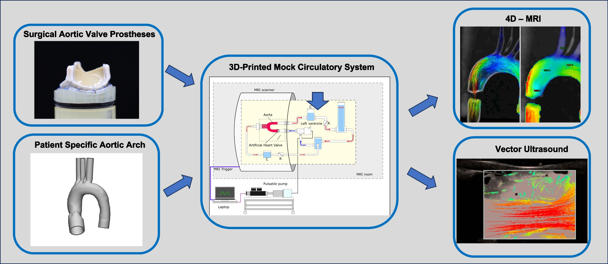 4D-Flow MRI and Vector Ultrasound in the In-Vitro Evaluation of Surgical Aortic Heart Valves – a Pilot Study
