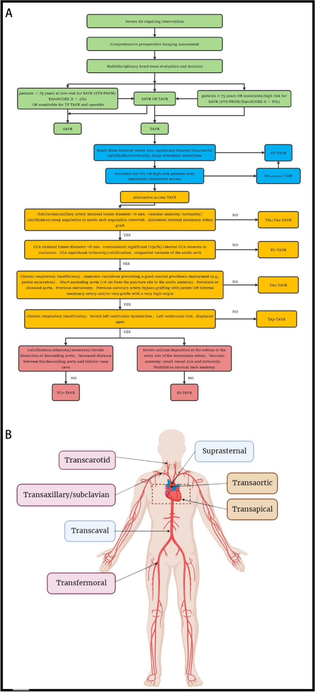 An Updated Comprehensive Review of Existing Transcatheter Aortic Valve Replacement Access