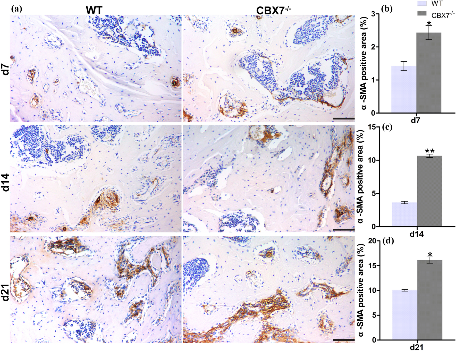 Correction: Effect of CBX7 deficiency on the socket healing after tooth extractions