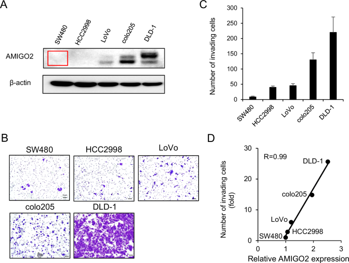 AMIGO2 enhances the invasive potential of colorectal cancer by inducing EMT