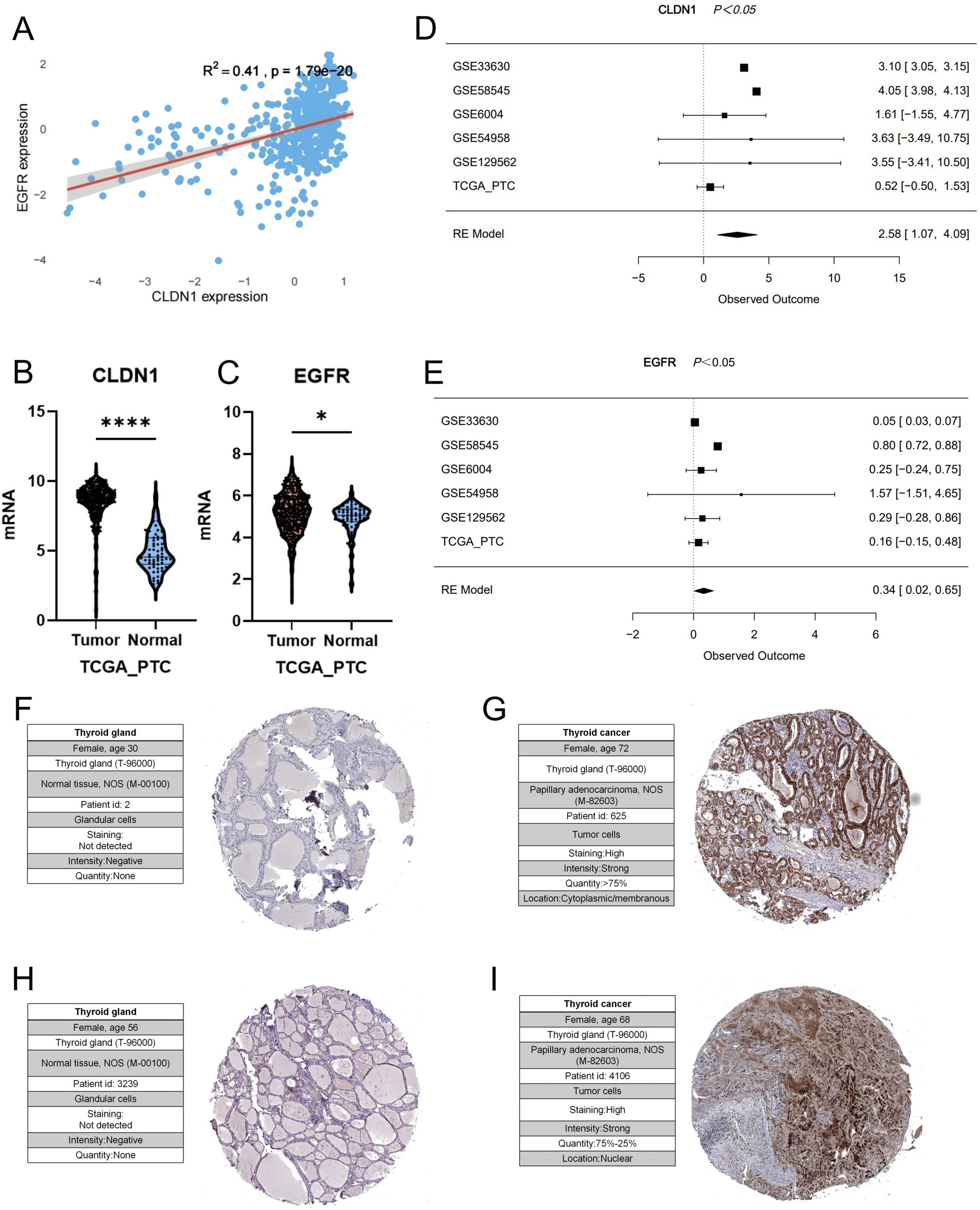 Expression of CLDN1 and EGFR in PTC