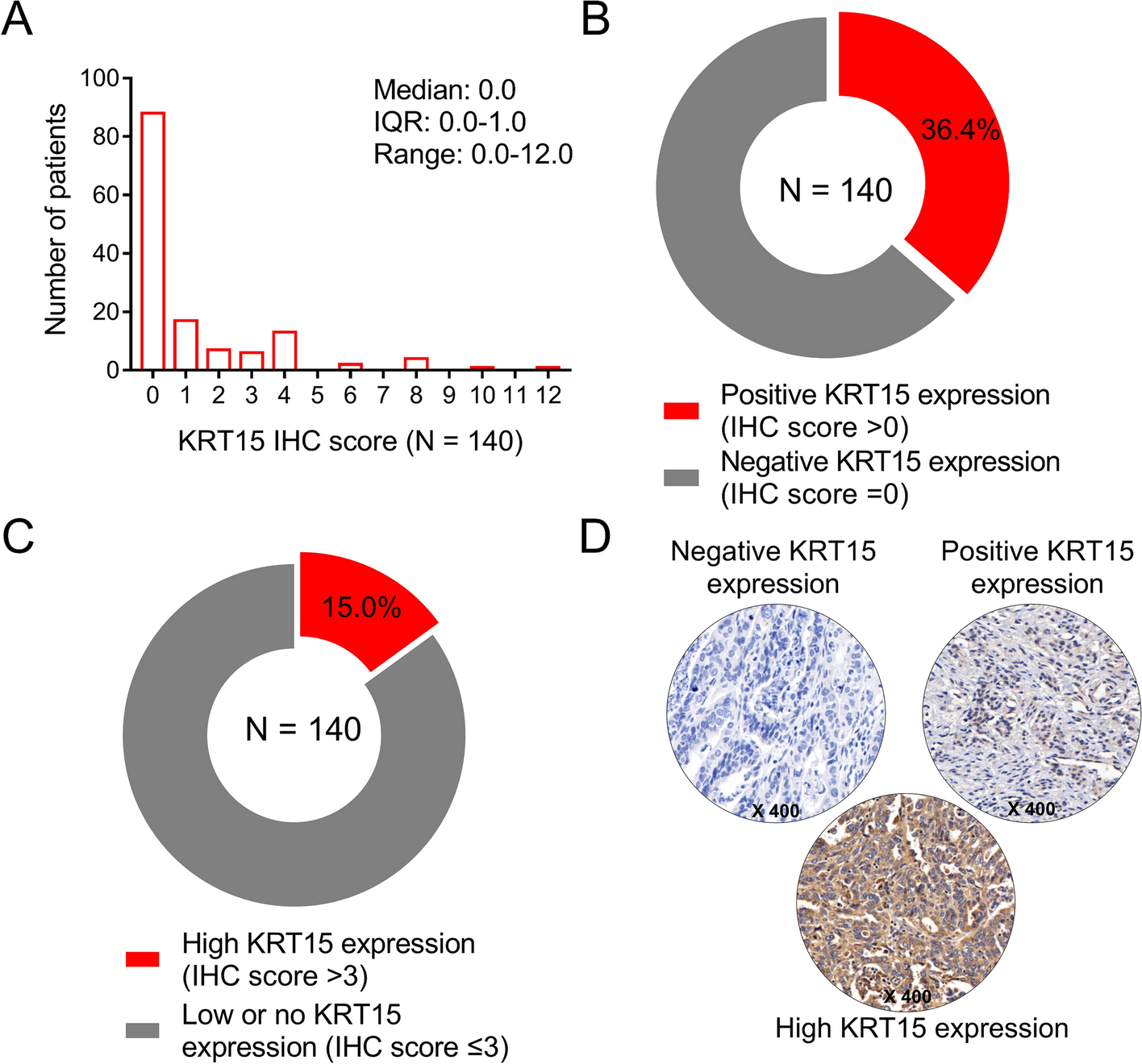 Keratin-15 high expression links with lymph node metastasis and poor survival prognosis in epithelial ovarian cancer patients