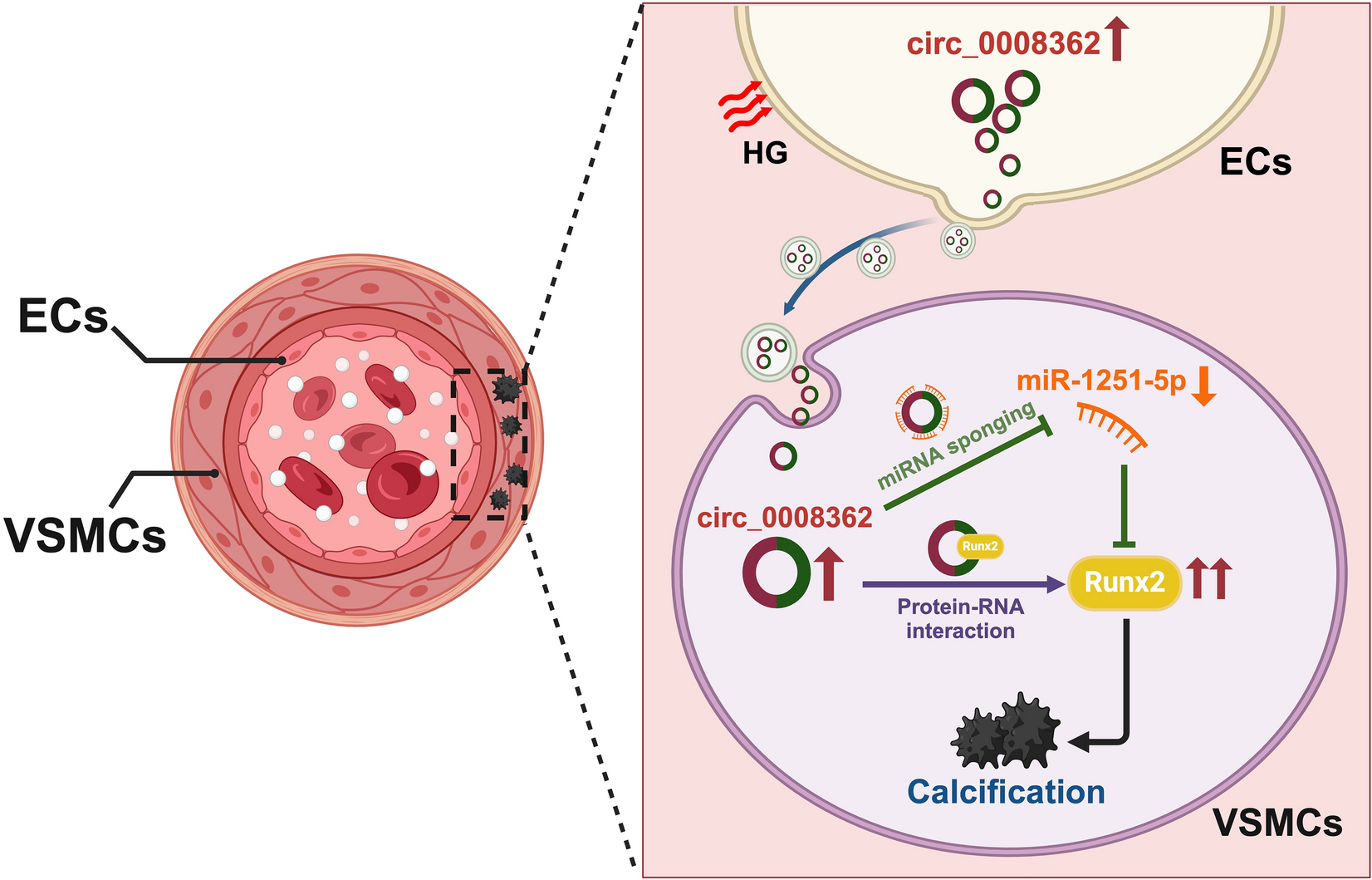 Endothelial cells derived extracellular vesicles promote diabetic arterial calcification via circ_0008362/miR-1251-5p/Runx2 axial