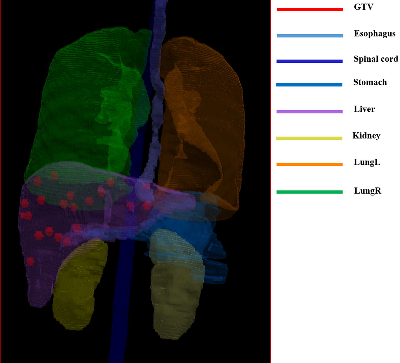 Impact of contrast-enhanced CT in the dosimetry of SBRT for liver metastases treated with MR-Linac