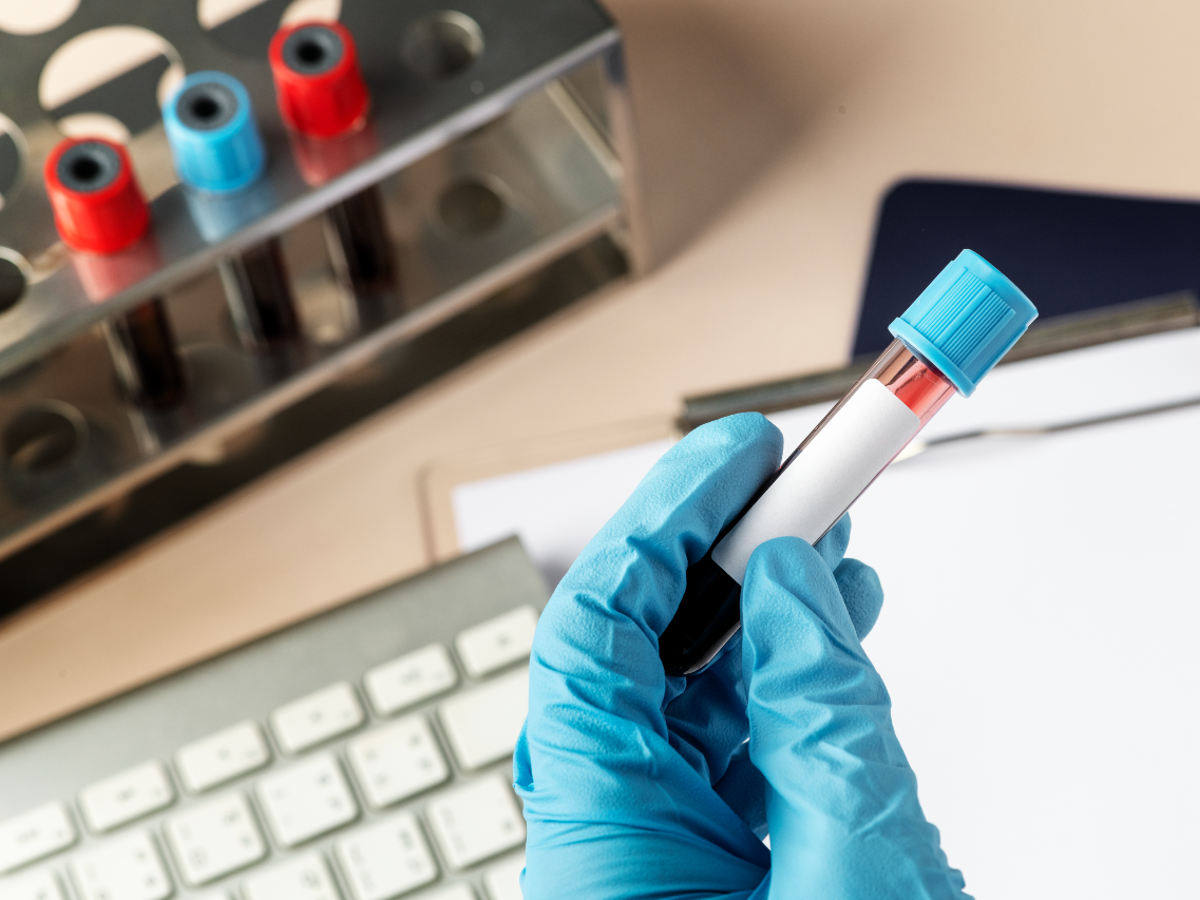 Feasibility, Preference, and Impact of a Rapid Multiplexed Point-of-Care Digital Innovation (AideSmart!) to Expedite Screening of Sexually Transmitted Blood-Borne Infections in At-Risk Populations in Canada: Cross-Sectional Study