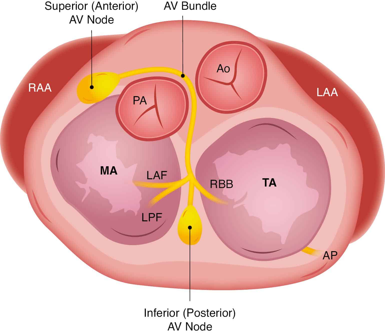 Supraventricular Tachycardias in Patients with Congenitally Corrected Transposition of the Great Arteries