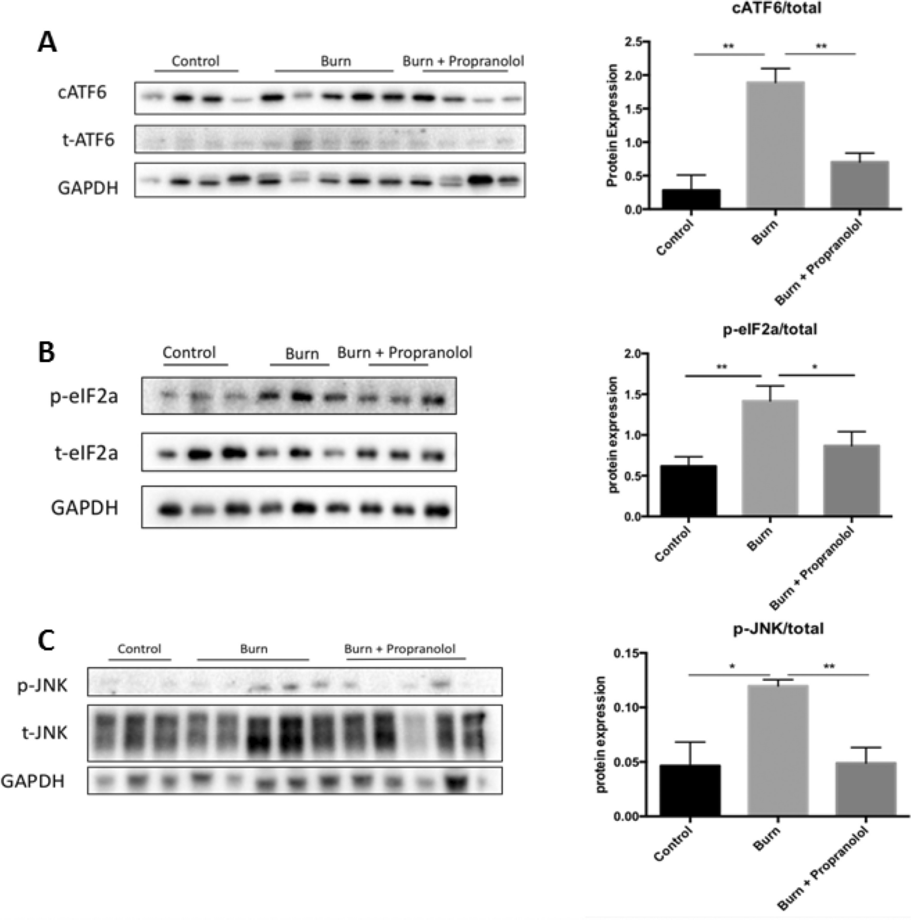 β-Adrenergic blockade attenuates adverse adipose tissue responses after burn