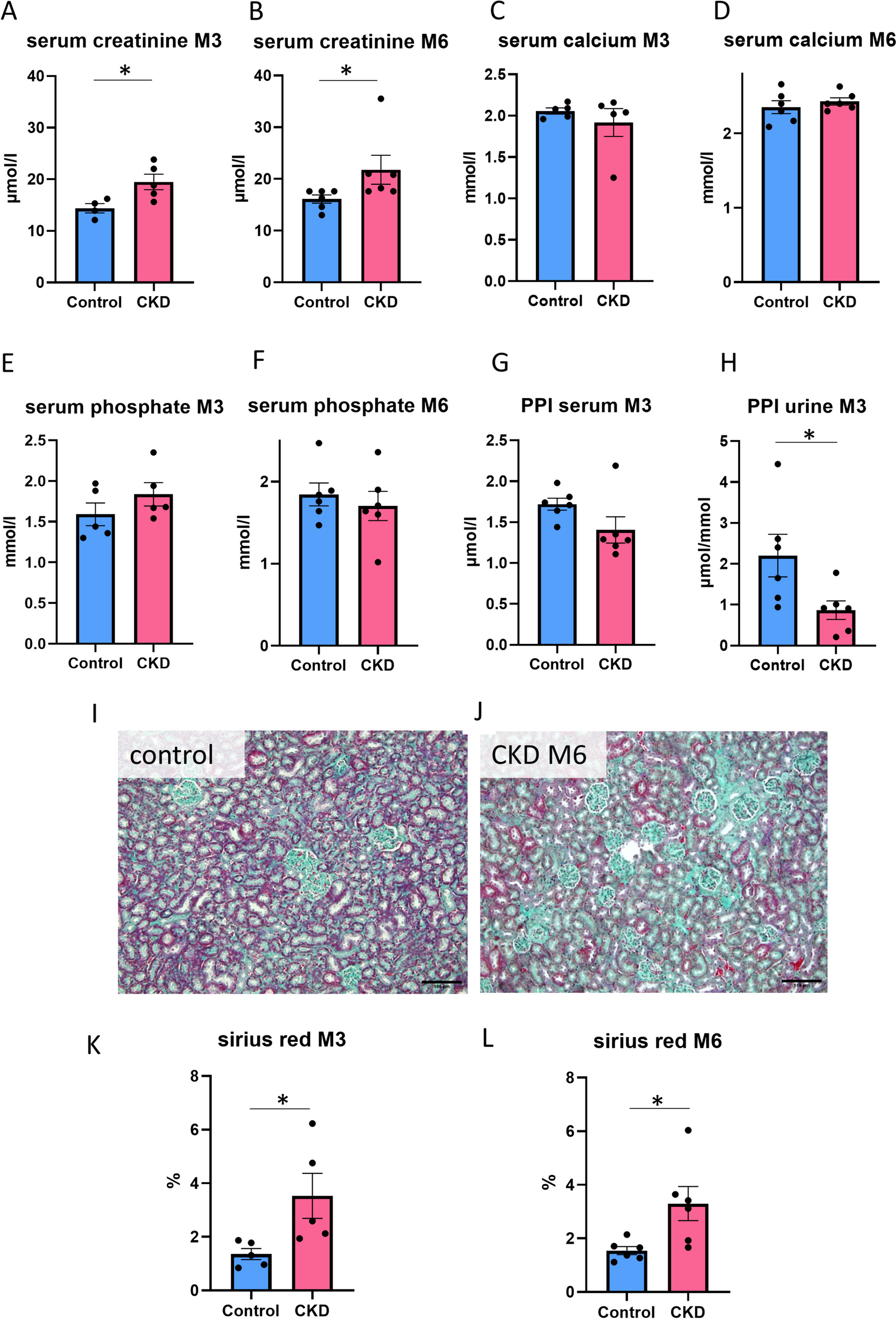 Oral pyrophosphate protects Abcc6-/- mice against vascular calcification induced by chronic kidney disease