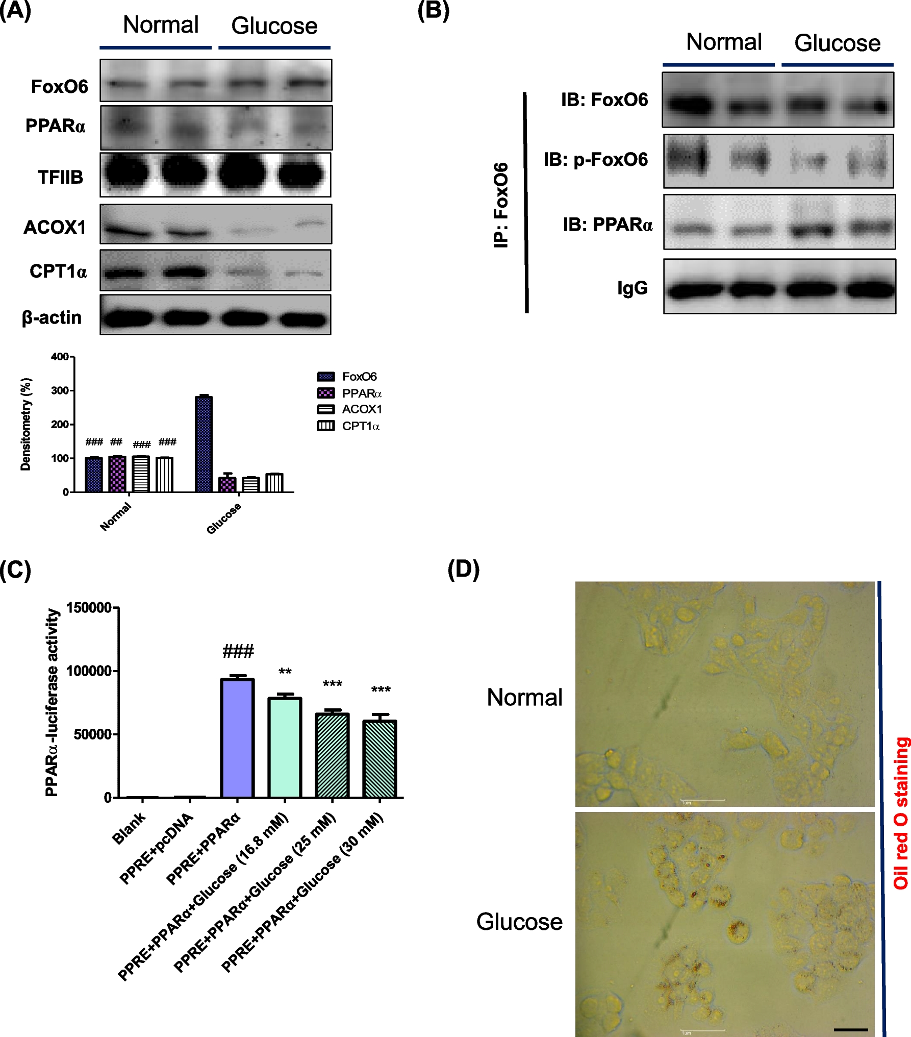 Endoplasmic reticulum stress induces hepatic steatosis through interaction between PPARα and FoxO6 in vivo and in vitro