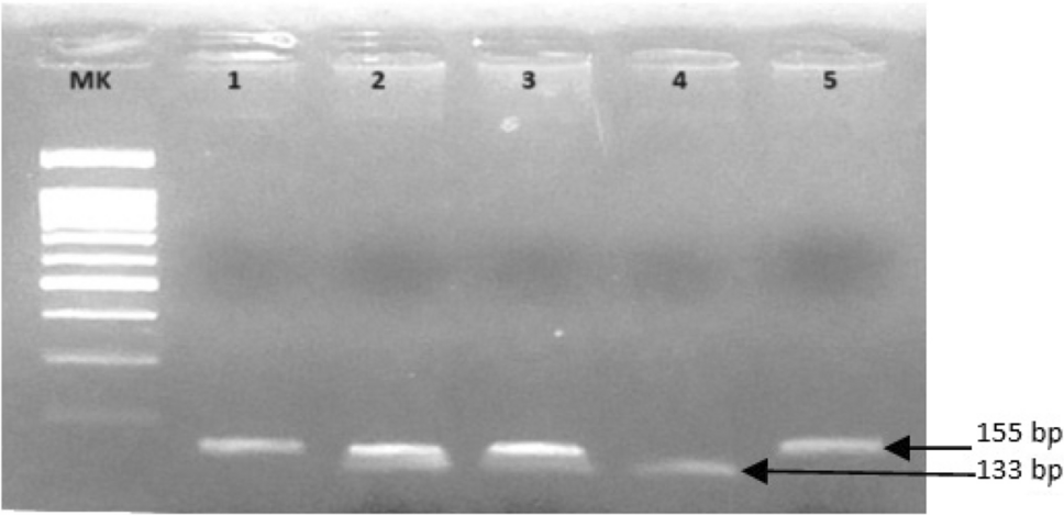 Involvement of CXCL10 rs4256246, CXCR4 rs2228014, CCR2 rs1799864 and CXCL16 rs2277680 in the Predisposition to Schizophrenia