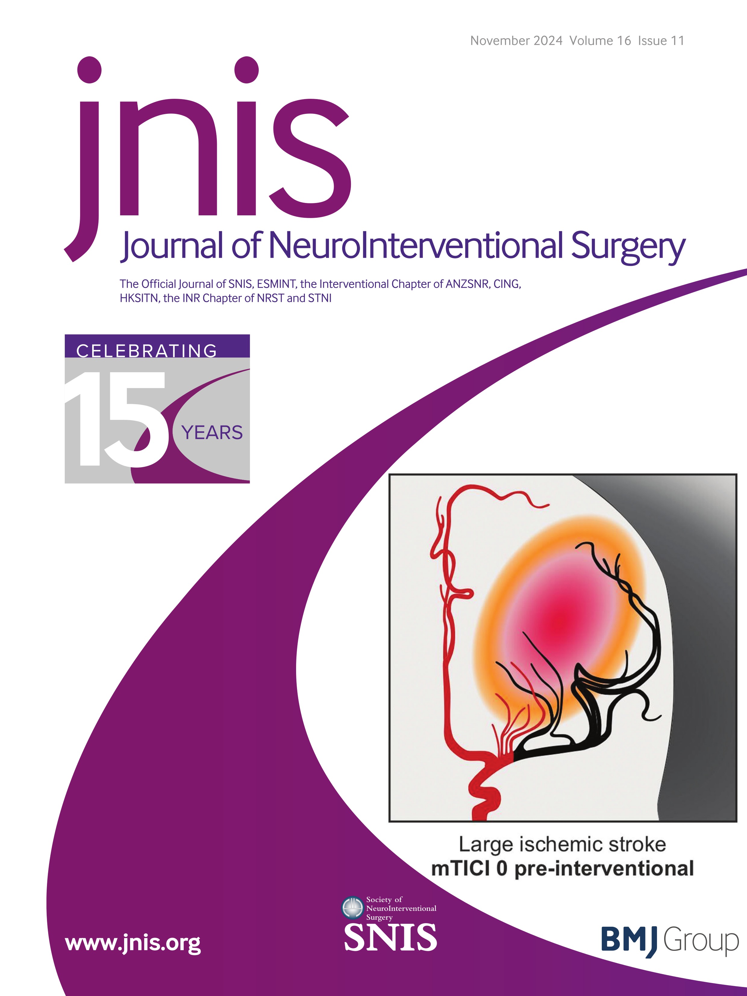Incidence of intracranial hemorrhagic complications after anterior circulation endovascular thrombectomy in relation to occlusion site: a nationwide observational register study