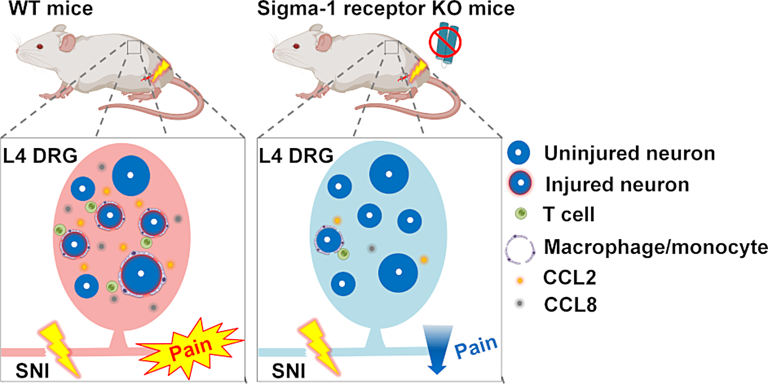 Sigma-1 Receptors Control Neuropathic Pain and Peripheral Neuroinflammation After Nerve Injury in Female Mice: A Transcriptomic Study