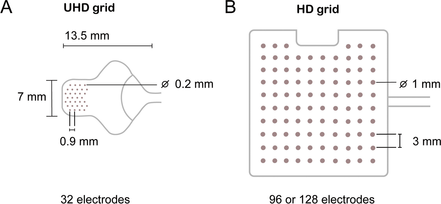 Effect of Electrode Distance and Size on Electrocorticographic Recordings in Human Sensorimotor Cortex