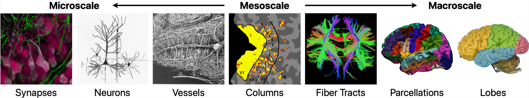 Mesoscale Brain Mapping: Bridging Scales and Modalities in Neuroimaging – A Symposium Review